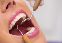Zastosowanie mas polieterowych w stomatologii